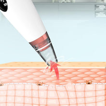 Load image into Gallery viewer, Blackhead Remover